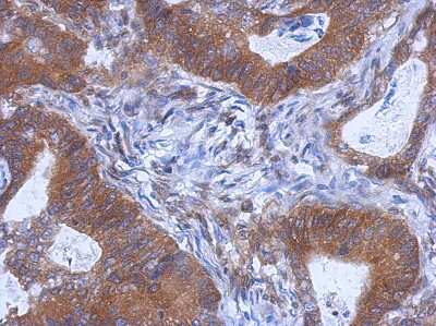 Immunohistochemistry-Paraffin: WDR85 Antibody [NBP2-20902]