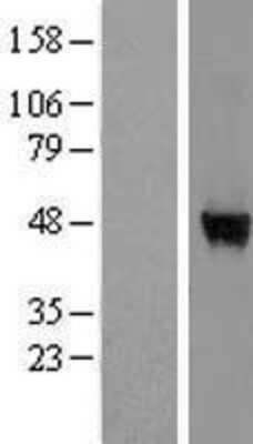 Western Blot: WDR85 Overexpression Lysate [NBL1-17833]