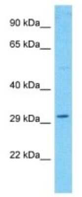 Western Blot: WDR86 Antibody [NBP3-09910]