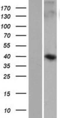 Western Blot: WDR86 Overexpression Lysate [NBP2-04721]