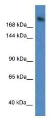 Western Blot: WDR87 Antibody [NBP1-91510]