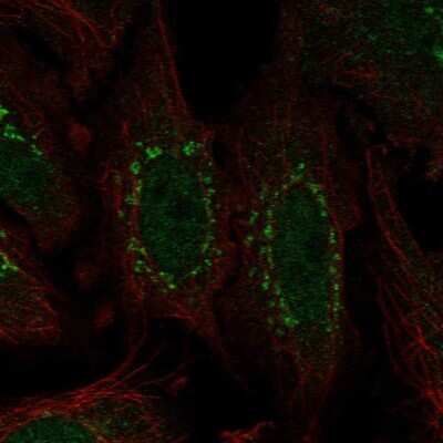 Immunocytochemistry/ Immunofluorescence: WDR88 Antibody [NBP2-58333]