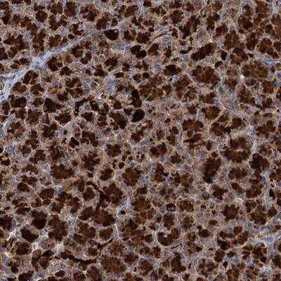 Immunohistochemistry-Paraffin: WDR88 Antibody [NBP1-90677]