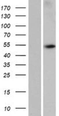 Western Blot: WDR88 Overexpression Lysate [NBP2-05135]