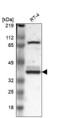 Western Blot: WDR89 Antibody [NBP1-88413]