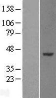 Western Blot: WDR89 Overexpression Lysate [NBL1-17834]