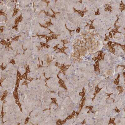 Immunohistochemistry: WDR9 Antibody [NBP2-38169]