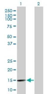 Western Blot: WDR9 Antibody [H00054014-B01P]