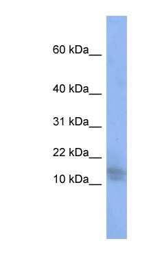 Western Blot: WDR9 Antibody [NBP1-54801]