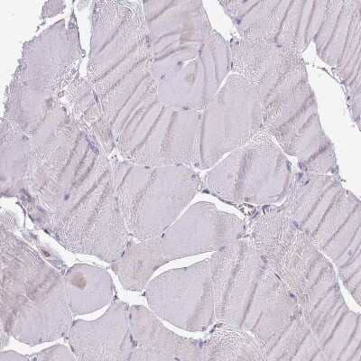 Immunohistochemistry-Paraffin: WDR90 Antibody [NBP2-31888]