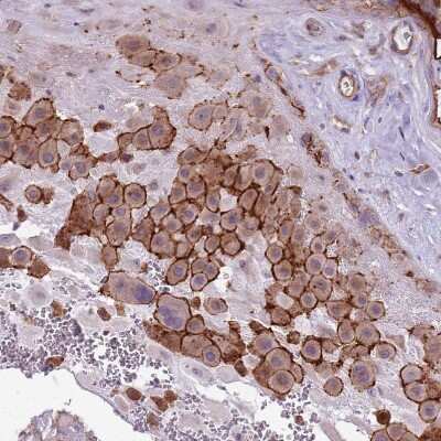 Immunohistochemistry-Paraffin: WDR90 Antibody [NBP2-31888]