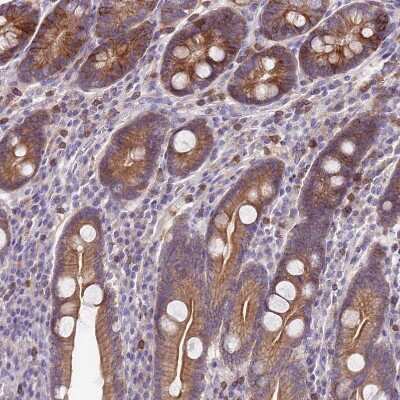 Immunohistochemistry-Paraffin: WDR90 Antibody [NBP2-31888]