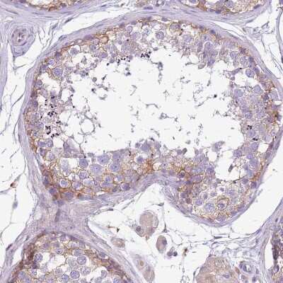Immunohistochemistry-Paraffin: WDR90 Antibody [NBP2-31888]
