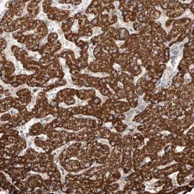 Immunohistochemistry-Paraffin: WDR91 Antibody [NBP1-83181]