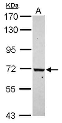 Western Blot: WDR91 Antibody [NBP2-20903]