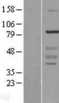 Western Blot: WDR91 Overexpression Lysate [NBL1-17835]