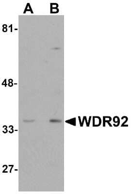 Western Blot: WDR92 AntibodyBSA Free [NBP1-76282]