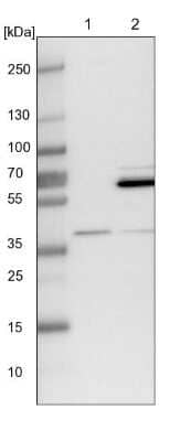 Western Blot: WDR92 Antibody [NBP1-92594]