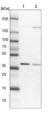 Western Blot: WDR92 Antibody [NBP1-92595]