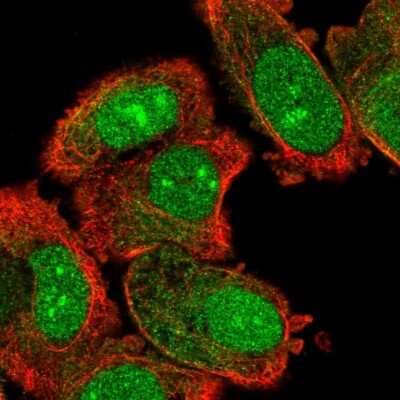 Immunocytochemistry/ Immunofluorescence: WDSOF1 Antibody [NBP2-47580]