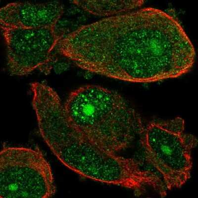 Immunocytochemistry/ Immunofluorescence: WDSUB1 Antibody [NBP2-54951]