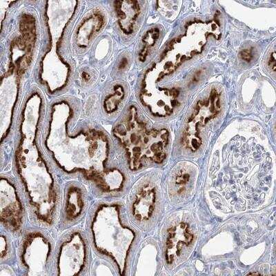 Immunohistochemistry-Paraffin: WDSUB1 Antibody [NBP1-83490]