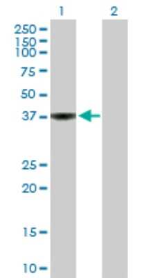 Western Blot: WDSUB1 Antibody [H00151525-B01P]