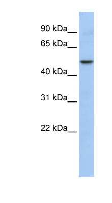 Western Blot: WDSUB1 Antibody [NBP1-55073]