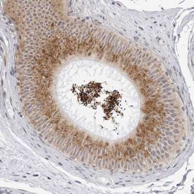Immunohistochemistry-Paraffin: WDTC1 Antibody [NBP1-89234]