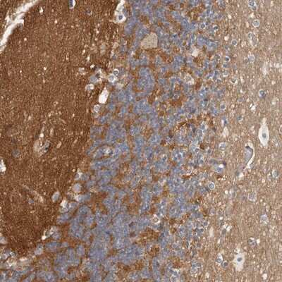Immunohistochemistry-Paraffin: WDTC1 Antibody [NBP1-89235]