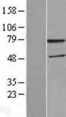 Western Blot: WDTC1 Overexpression Lysate [NBL1-17839]