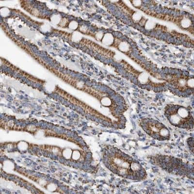 Immunohistochemistry-Paraffin: WFDC1 Antibody [NBP1-87207]