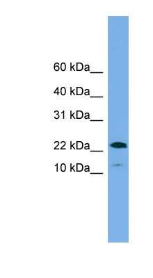 Western Blot: WFDC1 Antibody [NBP1-56613]