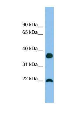 Western Blot: WFDC1 Antibody [NBP1-57714]