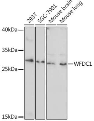 Western Blot: WFDC1 AntibodyAzide and BSA Free [NBP3-15532]