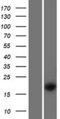 Western Blot: WFDC1 Overexpression Lysate [NBP2-06550]