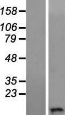 Western Blot: WFDC11 Overexpression Lysate [NBL1-17840]