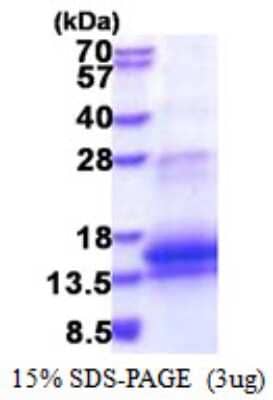 SDS-PAGE: Recombinant Human WFDC12 His Protein [NBP2-51521]