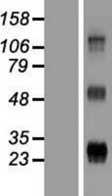 Western Blot: WFDC3 Overexpression Lysate [NBP2-05779]