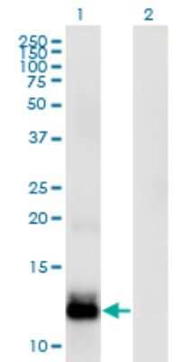 Western Blot: WFDC5 Antibody (5G5) [H00149708-M03]