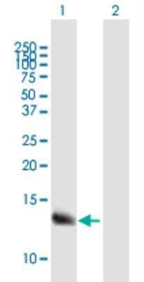 Western Blot: WFDC5 Antibody [H00149708-B01P-50ug]