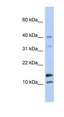 Western Blot: WFDC5 Antibody [NBP1-57932]