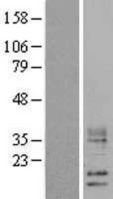 Western Blot: WFDC5 Overexpression Lysate [NBL1-17842]