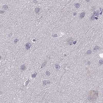 Immunohistochemistry-Paraffin: WFDC8 Antibody [NBP2-62671]