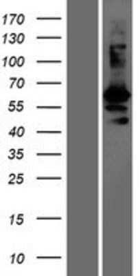 Western Blot: GASP-1/WFIKKN2 Overexpression Lysate [NBP2-05066]