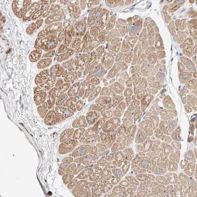 Immunohistochemistry-Paraffin: WFS1 Antibody [NBP1-84265]
