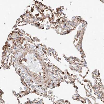 Immunohistochemistry-Paraffin: WFS1 Antibody [NBP1-84265]