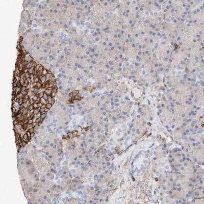 Immunohistochemistry-Paraffin: WFS1 Antibody [NBP1-84265]