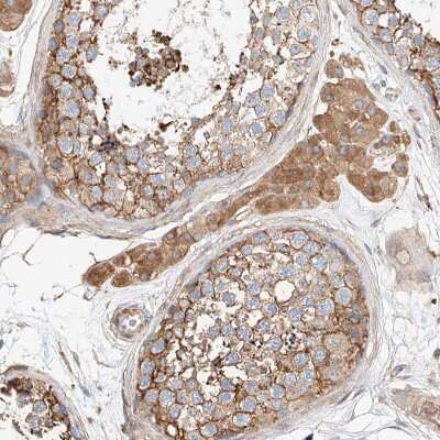 Immunohistochemistry-Paraffin: WFS1 Antibody [NBP1-84265]