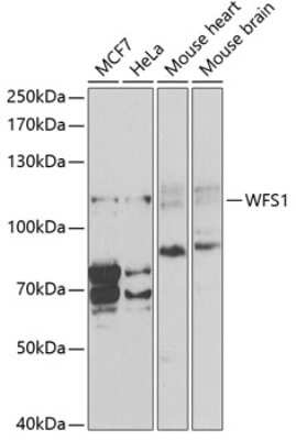 Western Blot: WFS1 AntibodyBSA Free [NBP2-94845]